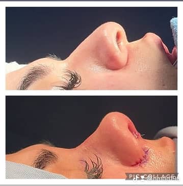 Slider image (5) Aesthetic and Oncologic Face, Head and Neck Clinic and OR